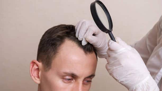 PRP For Hair Loss Treatments in NYC